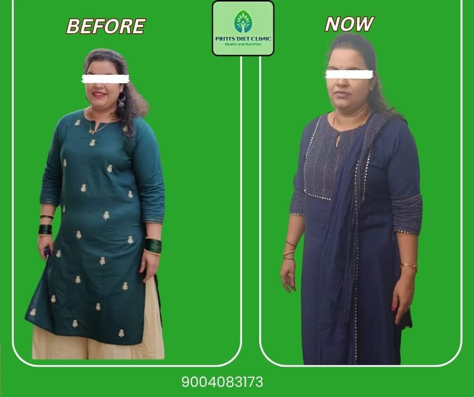 PRITIS-DIET-CLINIC-KALYAN-1